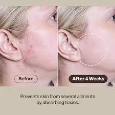 Relief Mud Mask - Celeb's Choice Mask